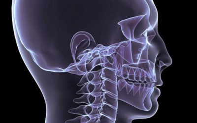 Kiefergelenkschmerzen, Kopfschmerzen – Diagnose CMD!